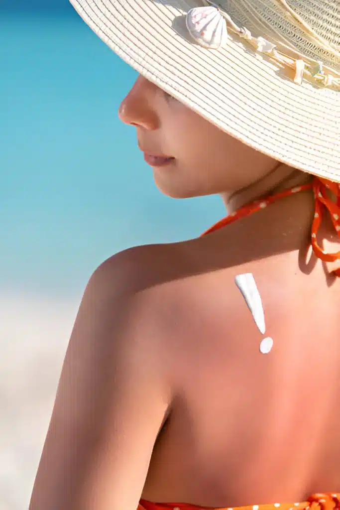 Sunburn Relief IV Therapy in arlington tx