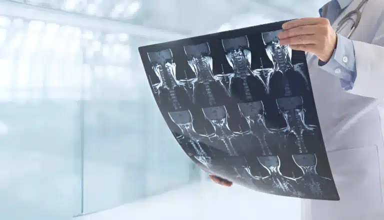 x ray in buurleson tx